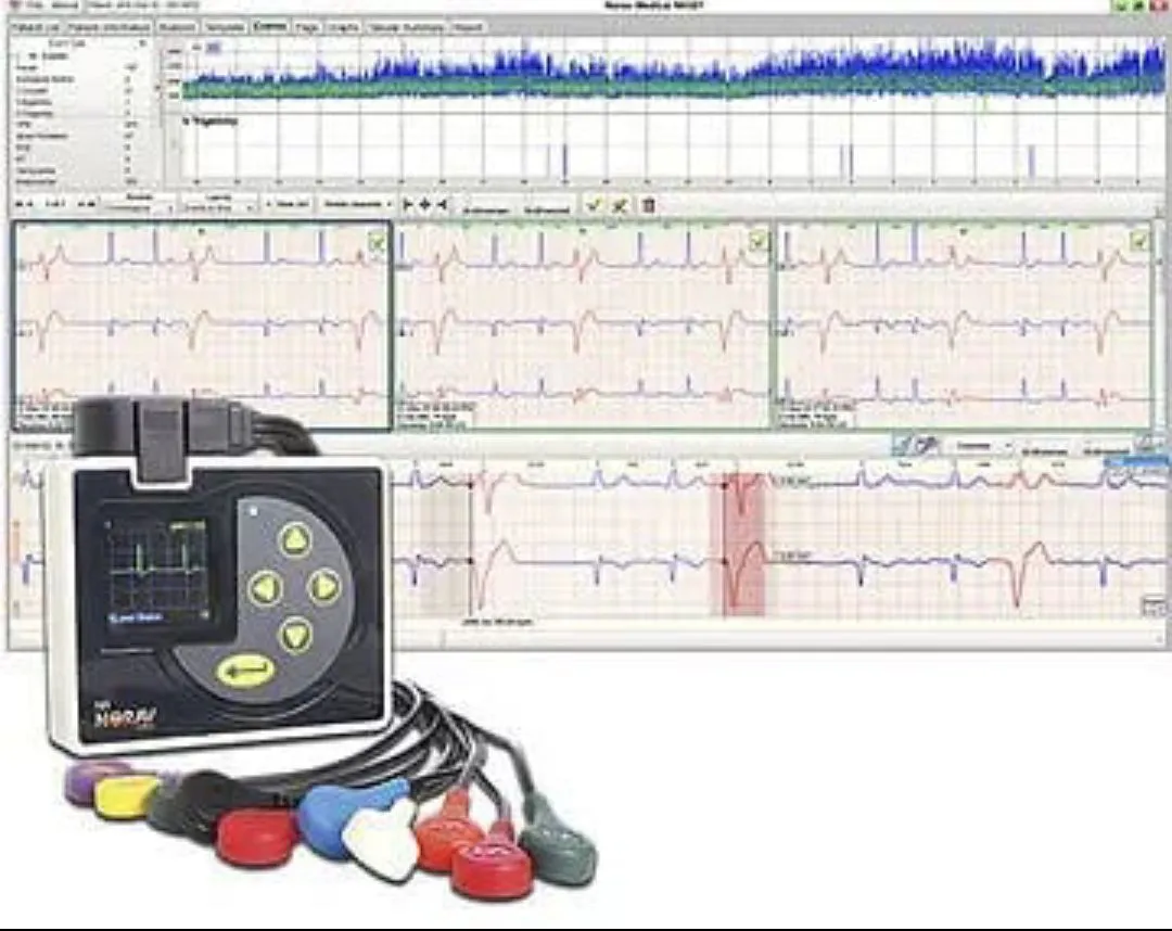 HOLTER DE ARRITMIAS CARDIACAS