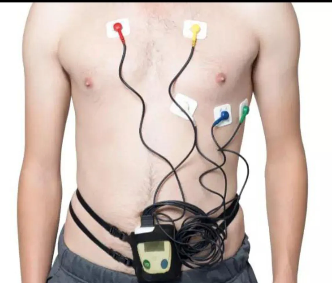 HOLTER DE ARRITMIAS CARDIACAS - Imagen 2