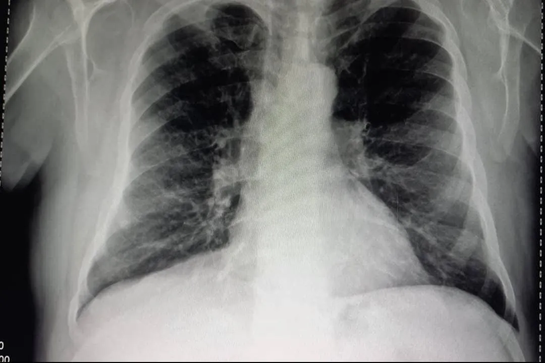 Terapia Respiratoria - Imagen 2